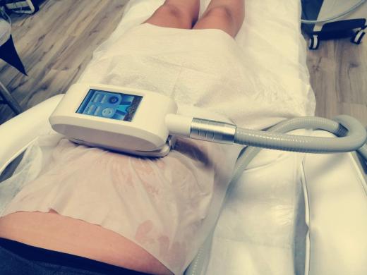 Krioterapijos aparatas su 360 tehnologija-1