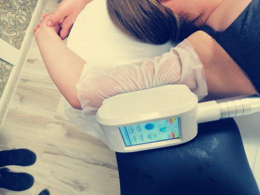 Krioterapijos aparatas su 360 tehnologija-2