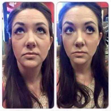 Instantly ageless - Momentinis atjauninimas-2