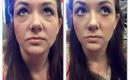 Instantly ageless - Momentinis atjauninimas-2