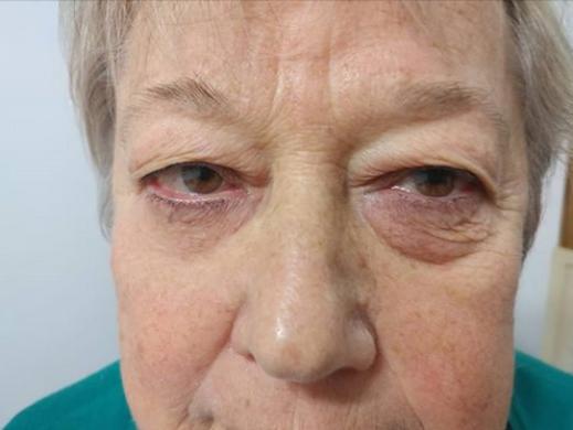 Instantly ageless - Momentinis atjauninimas-3