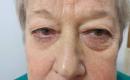 Instantly ageless - Momentinis atjauninimas-3