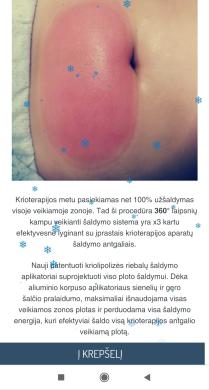 Krioterapijos aparatas su 360 tehnologija-7