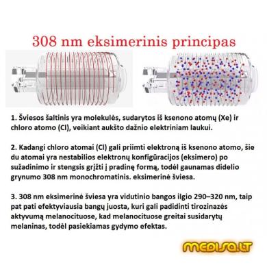 Profesionalus eksimerinis lazeris 308 nm-2