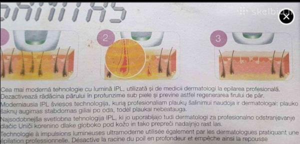 Plaukų šalinimo aparatas būdu-2